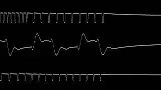 Smurfs, The (NES) - The Old Gold Mine [C64 6581 Cover] [Oscilloscope View]