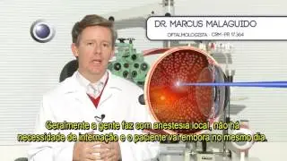Dr. Marcus Malaguido - Fotocoagulação a Laser da Retina