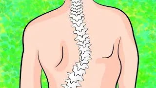 How to get rid of upper back scoliosis in 4 minutes a day