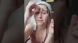 🍀ГИРУДОКОСМЕТОЛОГИЯ