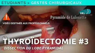 Comment réaliser une thyroïdectomie |  #3 Dissection du lobe pyramidal | Formation chirurgie ORL