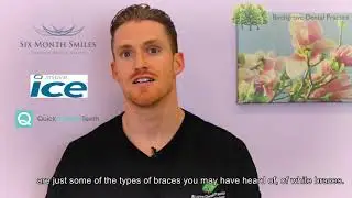 White Braces Cardiff – Six Month Smiles | Birchgrove Dental Practice