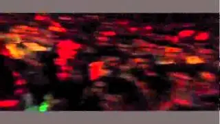 Skivi, Cozman & Dj First - We doin this ( LIVE ne Kamenice )