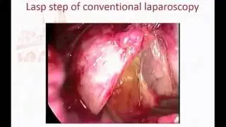 Lightbulb Moments in Radical Prostatectomy   Prof  R Gaston