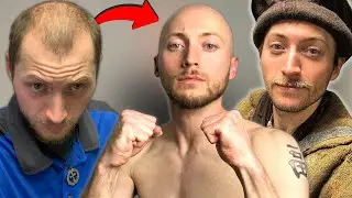 Shaving My Head Made Me Chase My Dreams (& Reach Them)