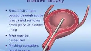 Cystoscopy