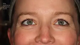 The Eye Love Project