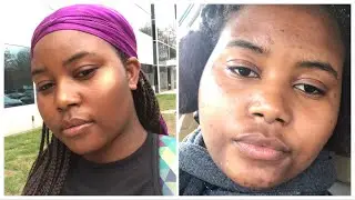 CLEAR SKINCARE ROUTINE