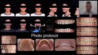 Дентальная фотография. Фотопротокол. Часть 1