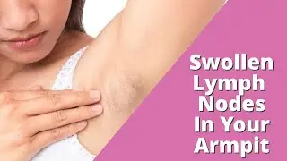 Swollen Lymph Nodes In Armpit | Lumps in Armpit