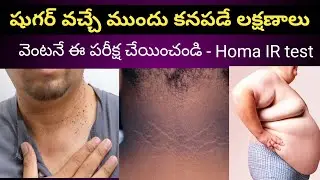 షుగర్ వచ్చే ముందు కనపడే లక్షణాలు - Homa IR Test | Symptoms before heading to Diabetes