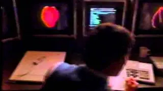 IBM technology for medical field commercial 1986