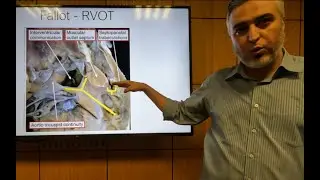 Tetralogy of Fallot (Part 1) - Hatem Hosny
