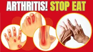 NEVER EAT These 12 Foods If You Have Arthritis | Hab Healthy