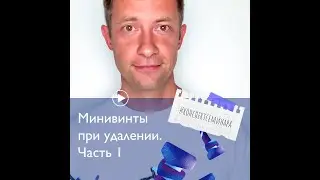 3. Минивинты при удалении. Часть 1 | 
