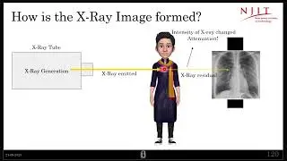 How is X-Ray image formed?  |Linear attenuation coefficient |, |mass attenuation coefficients|