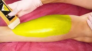 Sugaring legs with cartridges / cassettes - Fast and Easy