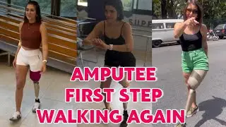 Amputee Lady Life After Amputation: Walking Again With Prosthetic Leg