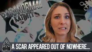 A Scar Appeared Out of Nowhere?! (a paranormal update/vlog)