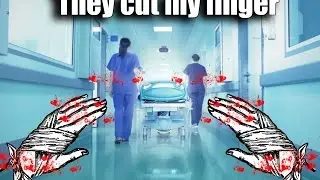 They Opened My Finger - Life Story #2