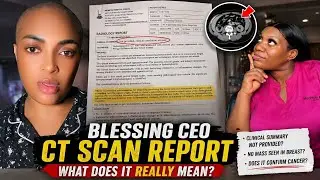     Blessing CEO CT Scan Explained | Can a CT Scan Diagnose Breast Cancer?