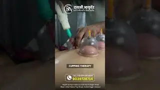 Experience the Benefits of Cupping Therapy | Dr. Manish Yadav | Rayshree Ayurveda | Kanpur