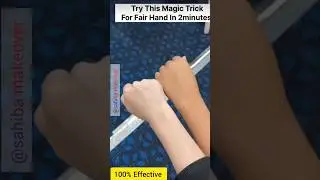 😱Magic Tricks For Fair Hand In 2 Mnts/Tanning Remove Homeremedy ll 