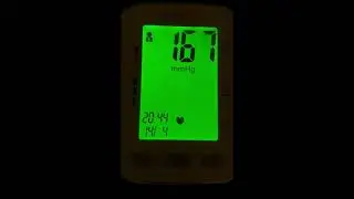 Female heart examination, heart sound, irregular beat