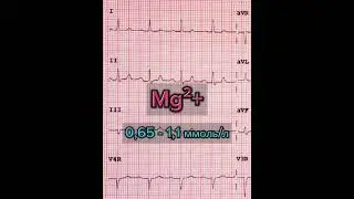 #гипомагнезиемия  #ecg #экг #кардиология