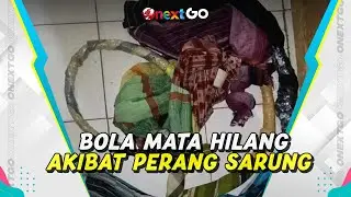 Seorang Bocah Kehilangan Bola Matanya Karena Perang Sarung | Onext GO