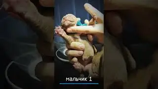 Щенки питбуля, помёт 