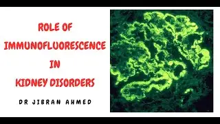 ROLE OF IMMUNOFLUORESCENCE IN DIAGNOSIS OF RENAL BIOPSY OR GLOMERULAR DISEASES II SIMPLY PATHOLOGY