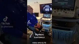 Inteligencia anatómica en el Hera W10 Elite. Parte 1