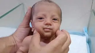 Part (9)  How to neonatal baby bottle feed care in NICU___# DailyUpdate# Bottlefeed# CuteBaby..