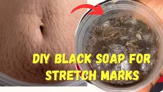 How to make Black soap for Stretch marks. Watch your stretch marks disappear after a month!