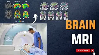 Brain MRI | Positioning and Planning Brain MRI | Working Principle
