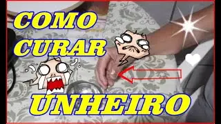 REMÉDIO CASEIRO PARA UNHEIRO, SAL E VINAGRE, ALHO COM AZEITE MORNO,