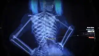 Harley Quinn visible heartbeat (Arkham Knight)