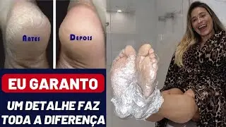 ACABE COM OS PÉS RESSECADOS E RACHADOS! O MELHOR TRATAMENTO CASEIRO PARA OS PÉS!