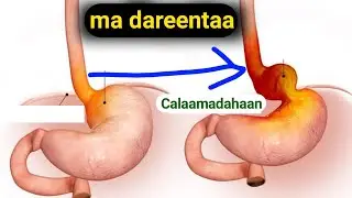 feera xanuun , oodinta , garba xanuun , kor hur , tabar Dari , walwal, wadna xanuun , naqas , daaco