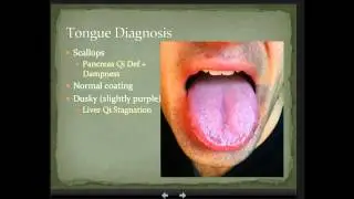 Tongue Diagnosis in Chinese Medicine