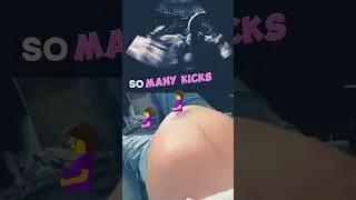 Baby too much Kicks🤰 🦶#pregnancy #baby #ultrasound #babyboy #shorts