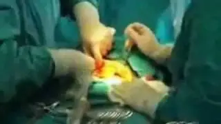 En la Cesarea de Karencita