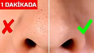 SİYAH NOKTALARI 1 DAKİKADA BURUNDAN SÖKÜN - Para Harcamadan Cilt Bakımınızı Yapın │ Güzellik Bakım