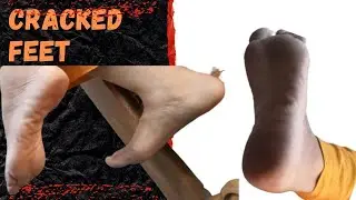 Sexy wrinkled cracked soles