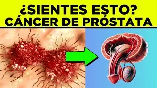 CÁNCER de PRÓSTATA: Señales Iniciales que Podrías estar Ignorando