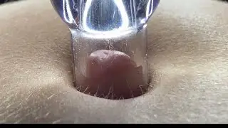 Outie play 2 (with suction 😏)