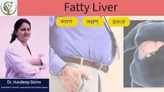 फैटी लिवर के लक्षण और उपाय | How to reduce fatty liver by Dr Hardeep Bains #fattyliver