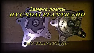Replacement of the pump Hyundai Elantra HD (J4)