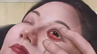 Ear ASMR| worms in ears|red ants crawling on   face